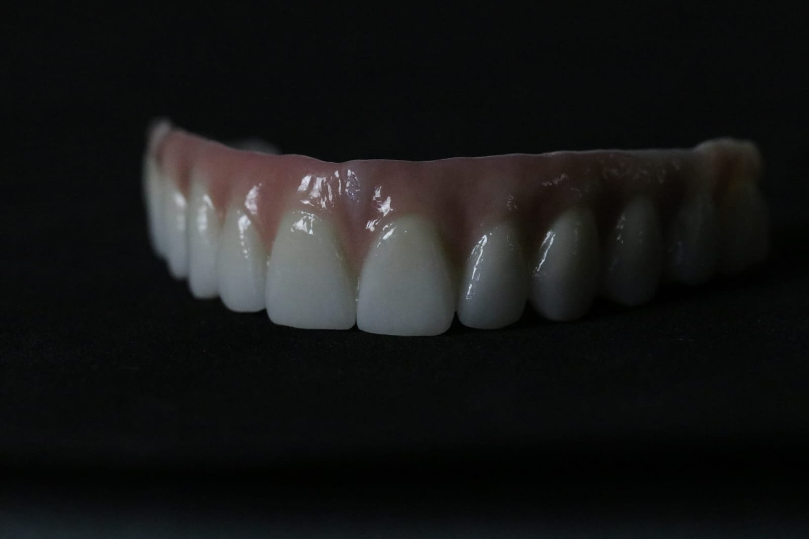 all-on-4-implant-dentaire-rabat