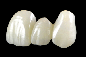 DENTAL CROWN RABAT AGDAL DENTAL CROWN RABAT AGDAL
