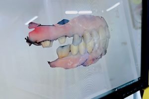 dental scanner dental scanner